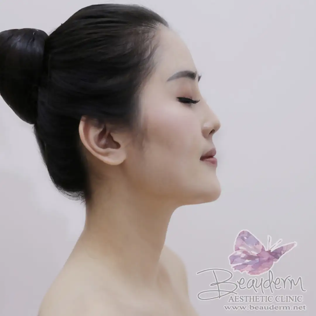 Beauderm Clinic Treatment Services