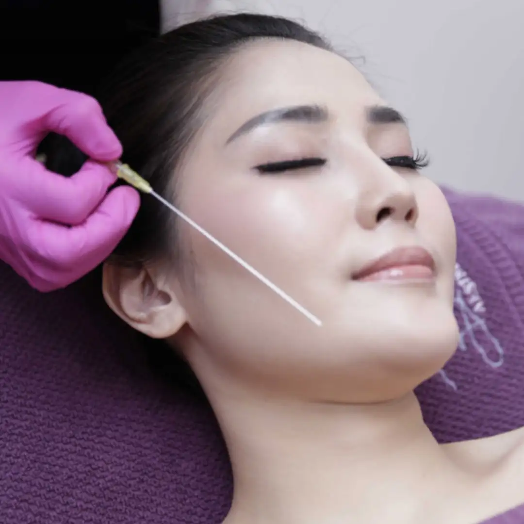 Threadlift Wajah