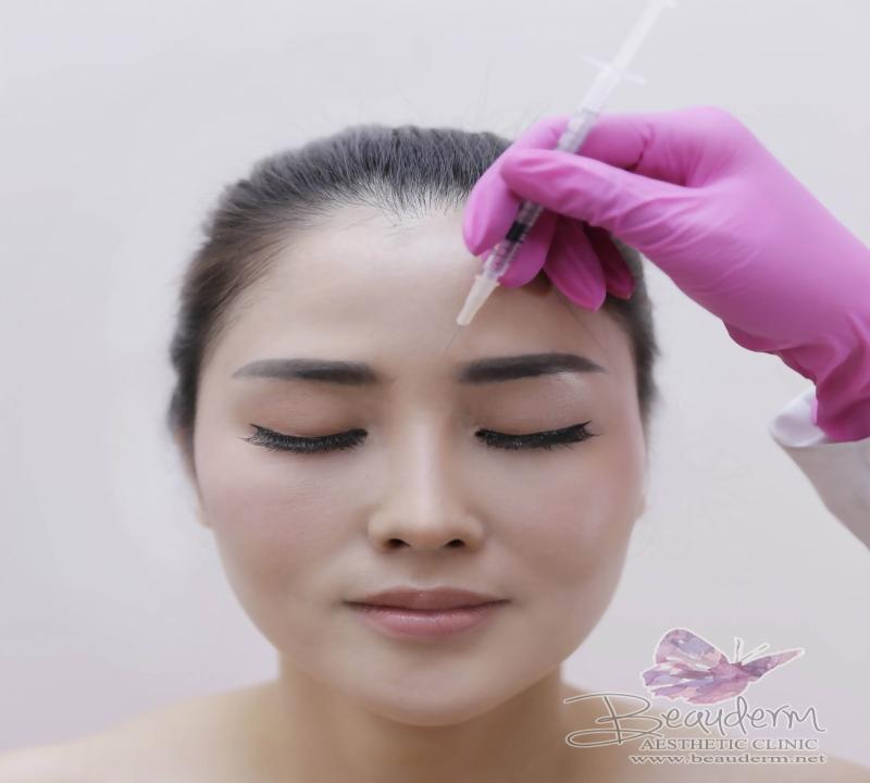 Manfaat Skin Booster Untuk Kulit Wajah