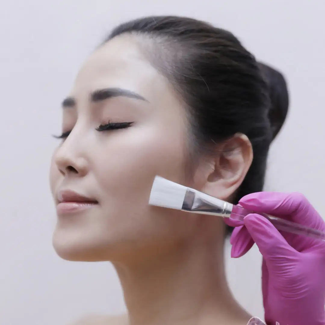 Skin Peeling