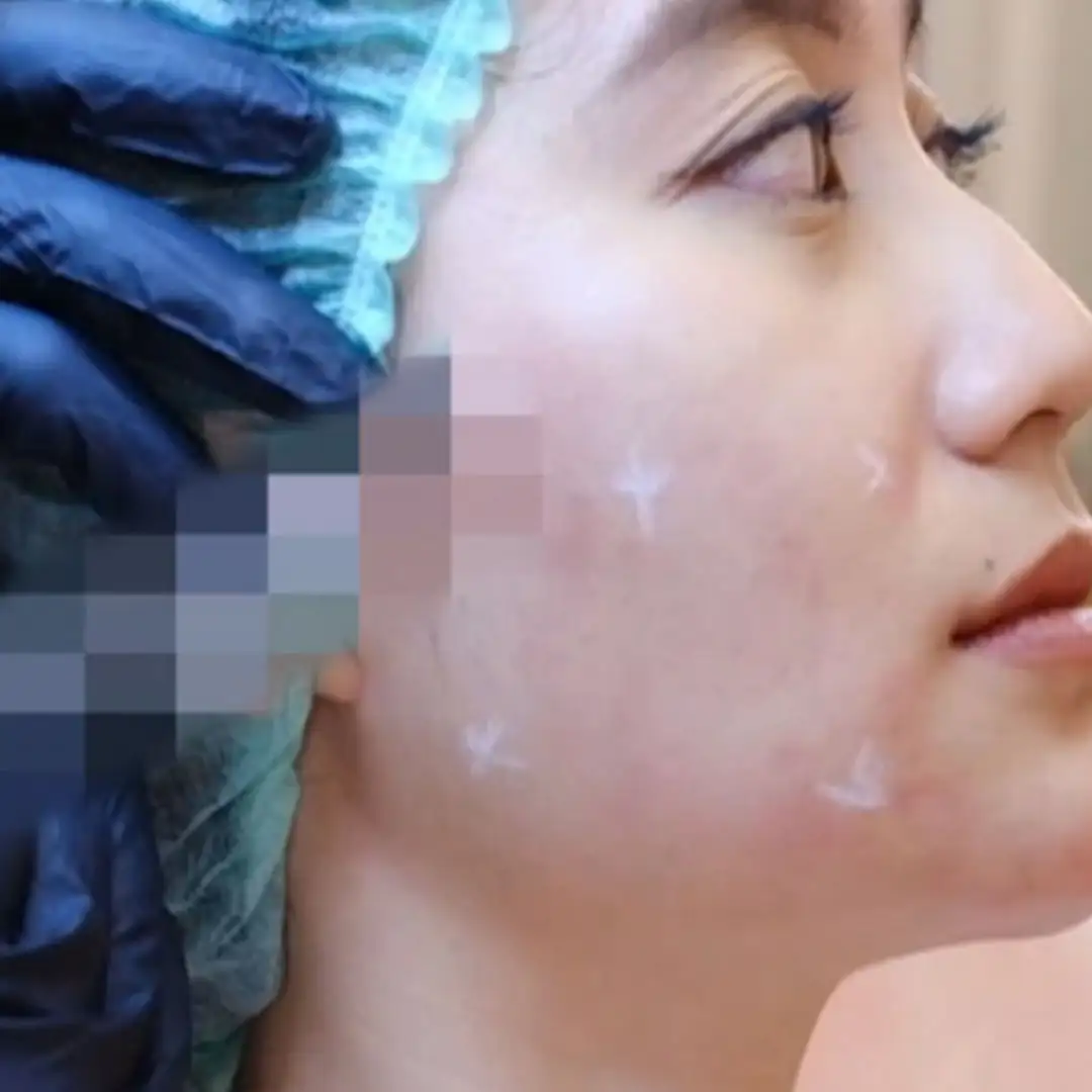 Injectable Skincare Glow