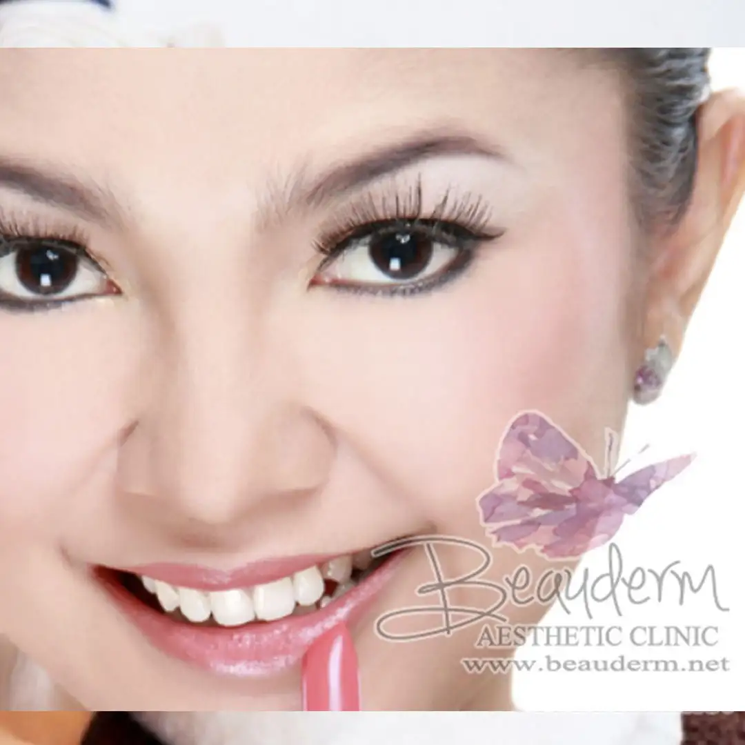 Cantikan Mana? Perubahan Pada 6 Artis Sebelum Dan Sesudah Di Filler