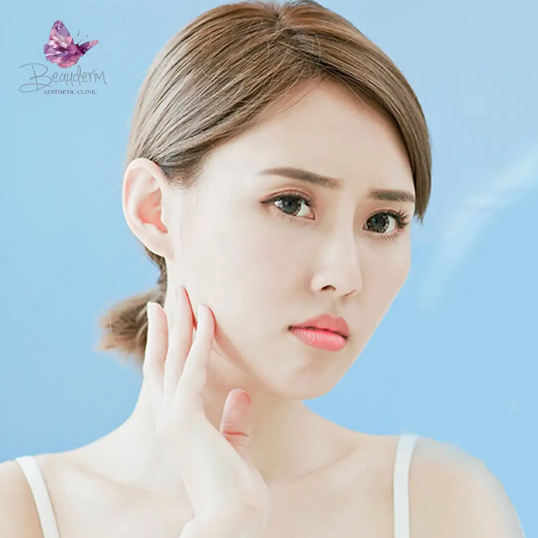 Cara Membuat Filler Tahan Lama Serta Tips Memperpanjang Hasil Filler