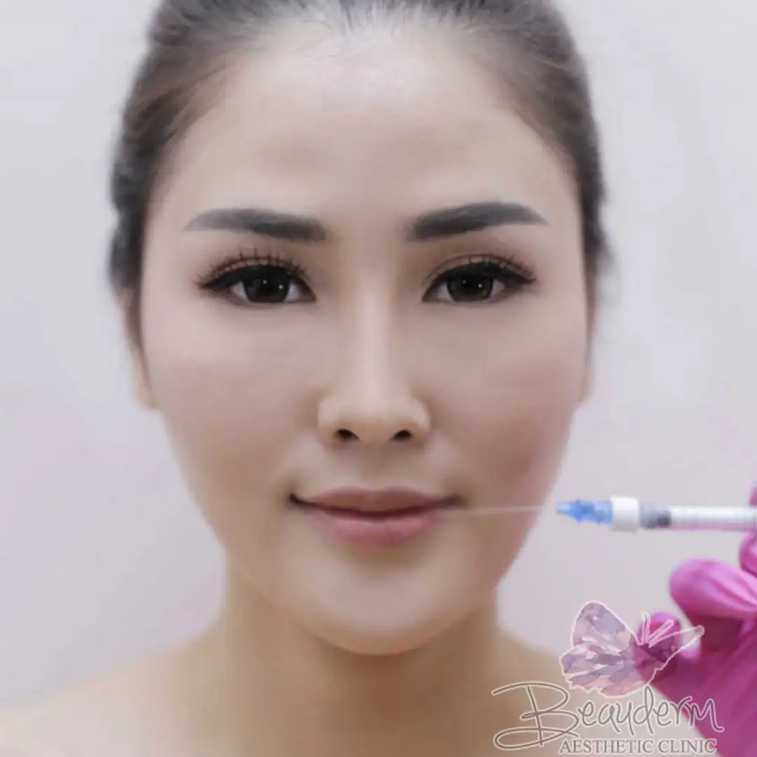 Punya Bibir Tipis, Kering? Berikan Volume Bibir