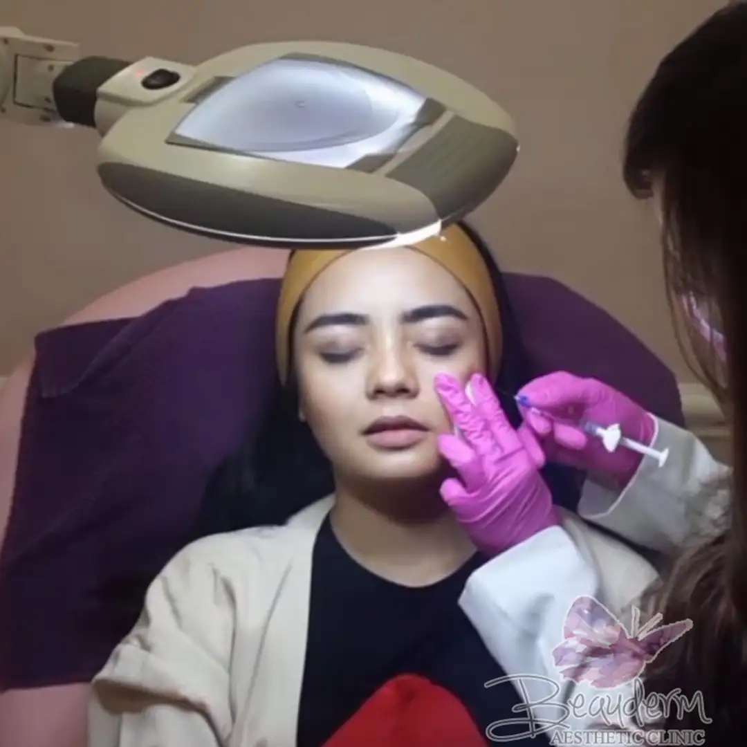 Filler Bawah Mata Hilangkan Mata Panda