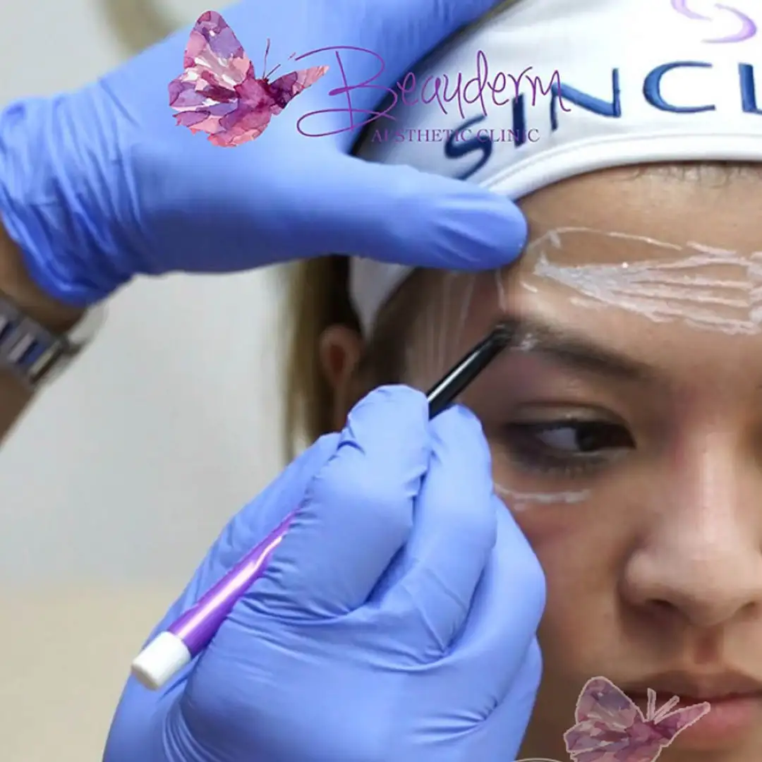 Eyebrow Lift Biostimulator