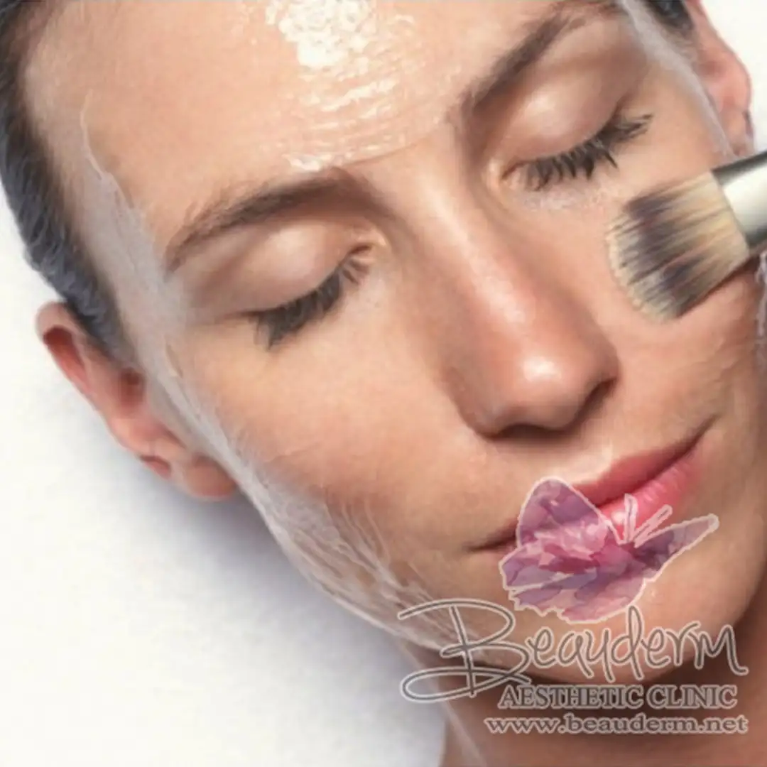 Begini Prosedur Perawatan Chemical Peeling Yang Benar