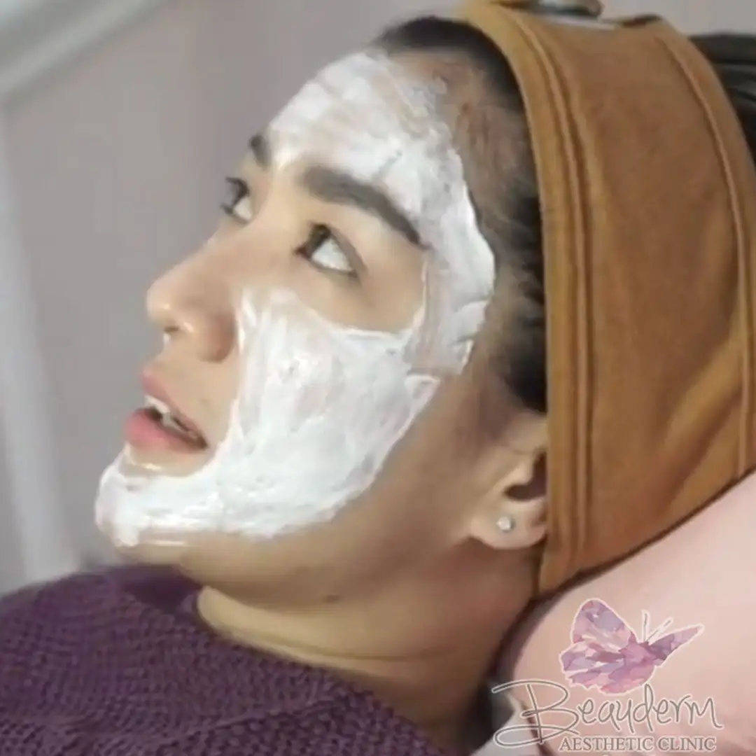 Skinbooster Treatment