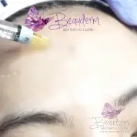 Perawatan Estetika Dahi Cekung Bergelombang Maupun Keriput
