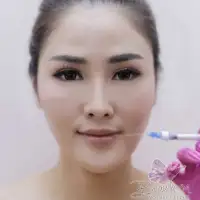 Punya Bibir Tipis, Kering? Berikan Volume Bibir