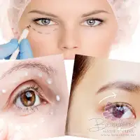Terlihat Makin Menarik & Bebas Kantung Mata (Eye Bag)