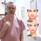 Wajah Langsung Tirus & Hidung Mancung Seketika! Lupakan Hasil Lama, Coba 2 Treatment Instan Ini