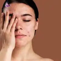Atasi Flek Dengan Skinbooster